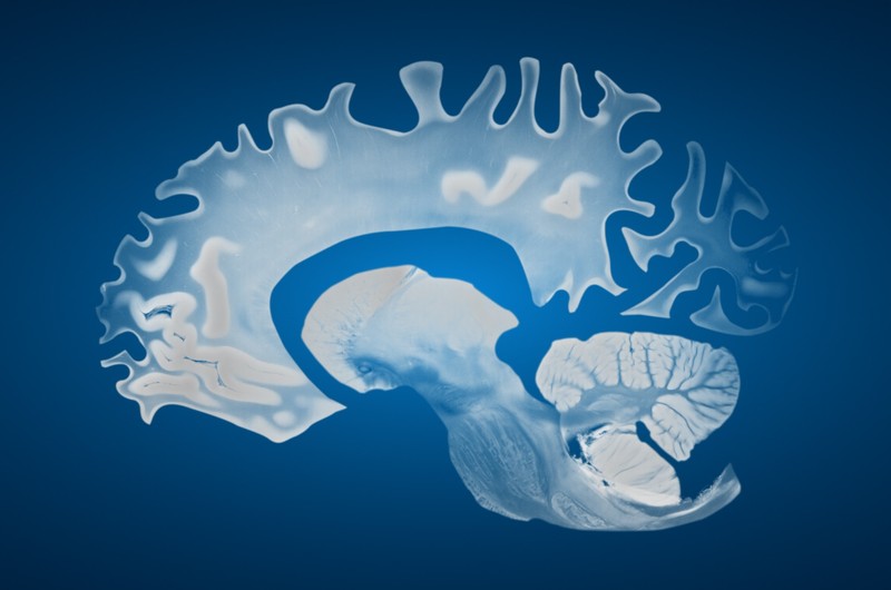 스트레스가 뇌를 망치는 방식과 회복의 메커니즘 1 1